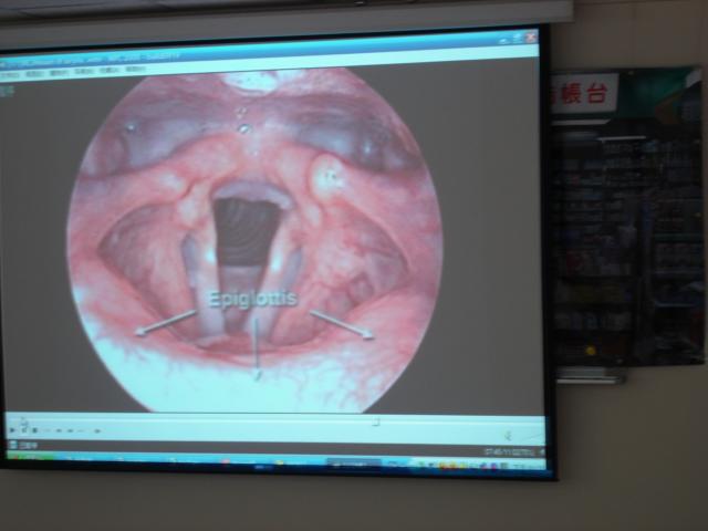 呂宜興醫師透過電腦影片播放讓學員們透過生動的影片介紹瞭解人類聲帶構造及如何運作
